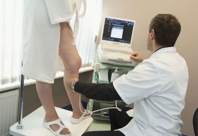 Varicose vein diagnosis